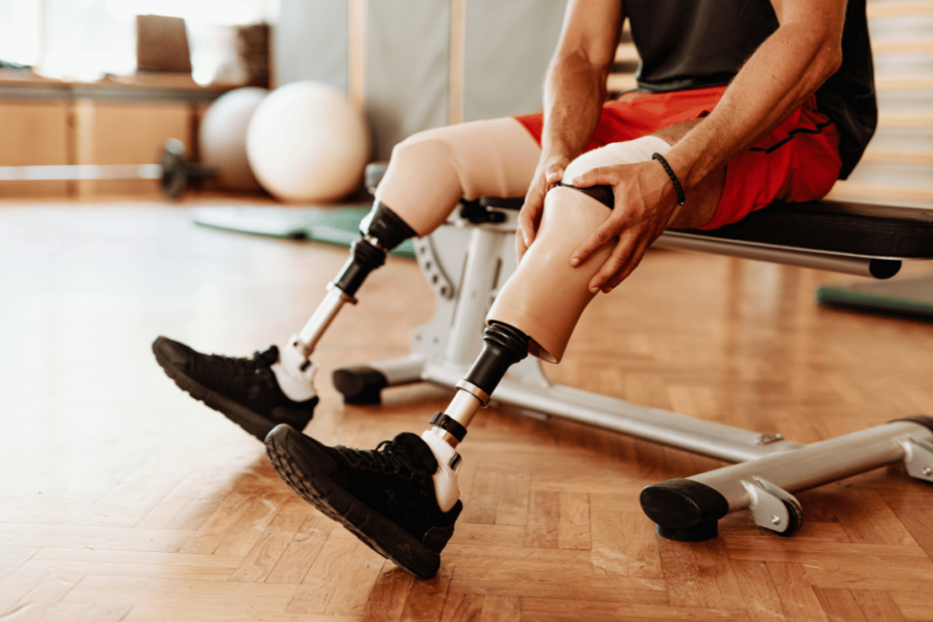 man with a prosthetic leg sitting on a bench 