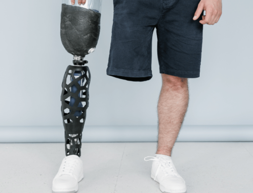 The Future is Here: Top Advancements in Prosthetic Technology