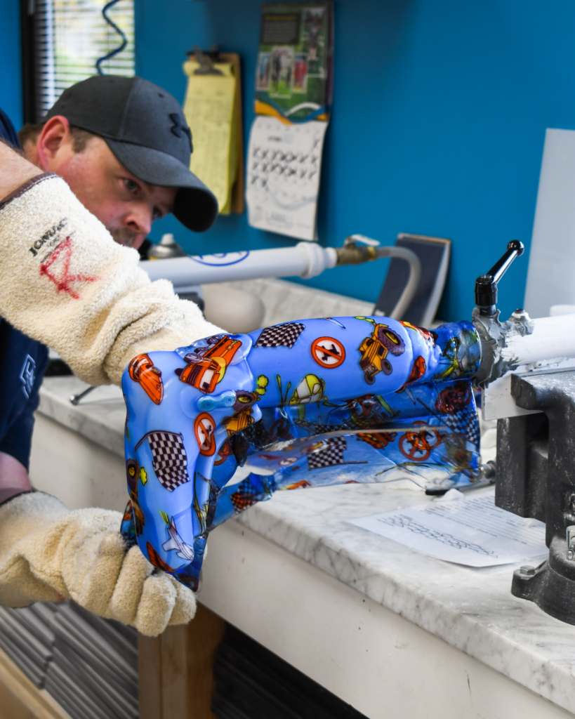 Hand crafted orthotic at Lawall