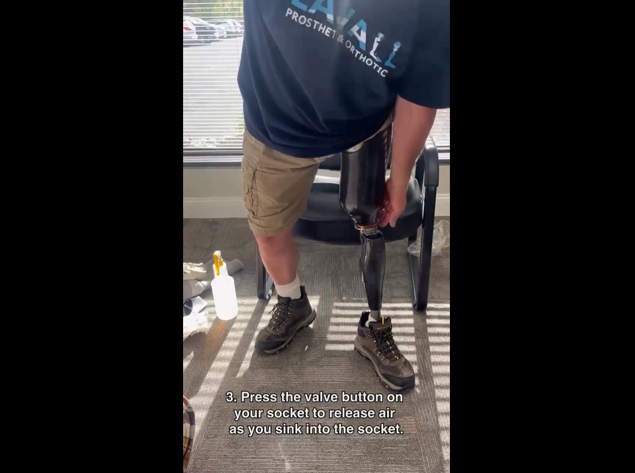 How to put on suction suspended prosthetic