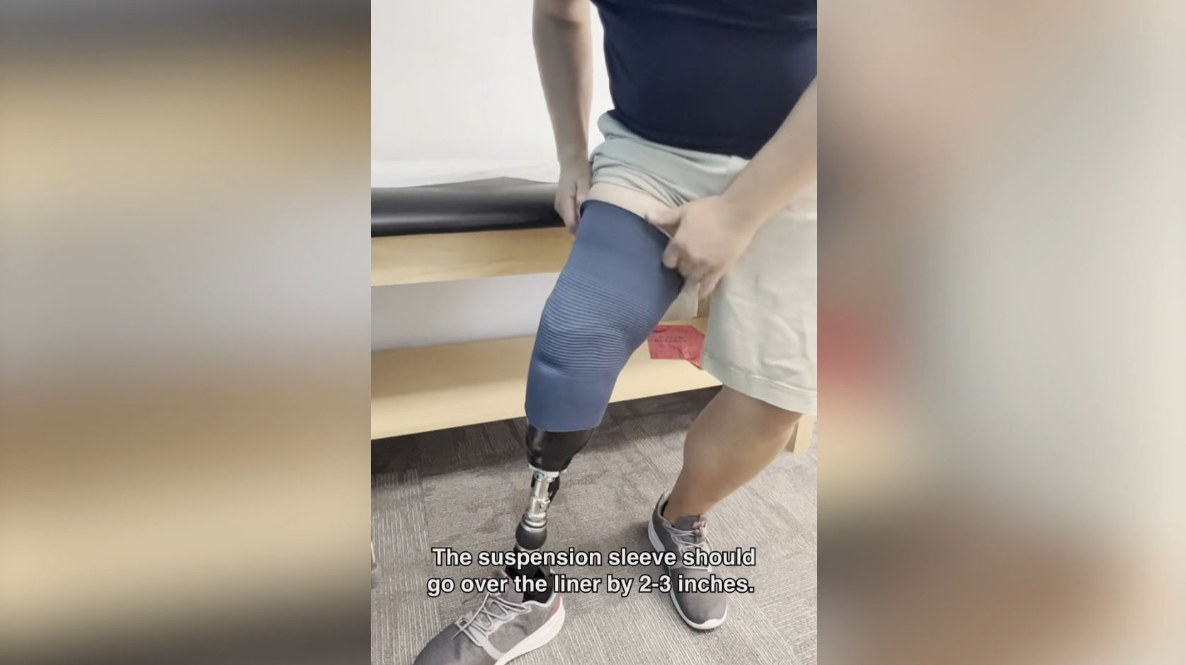 Putting on a Prosthesis with a Suspension Sleeve