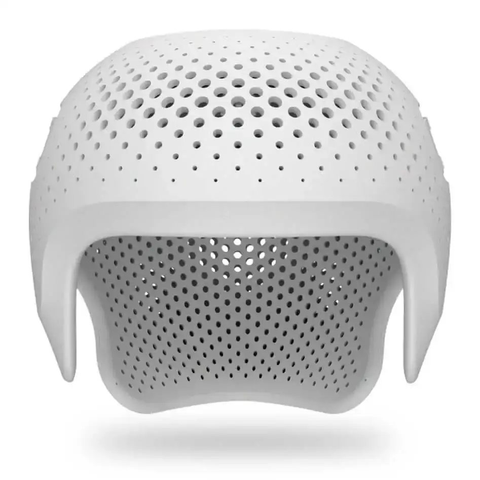 3D printed Cranial Remolding Helmet for infant