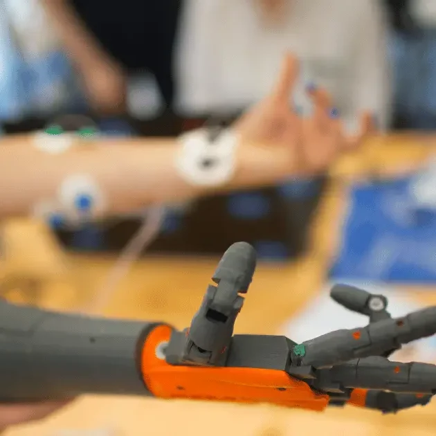 Bionic Arm Prosthetic