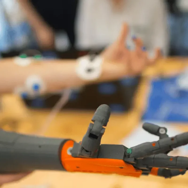 Bionic Arm Prosthetic