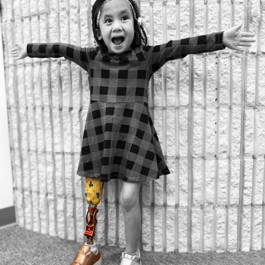 Girl with prosthetic leg | Lawall Prosthetic & Orthotic Services