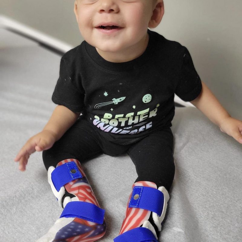 Lower Limb Orthotics for Children