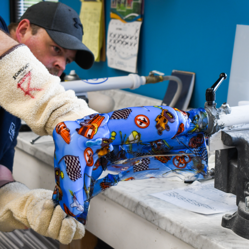 Hand crafted orthotic at Lawall