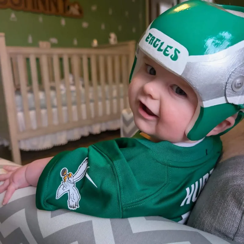 cranial-molding-helmet-Eagles