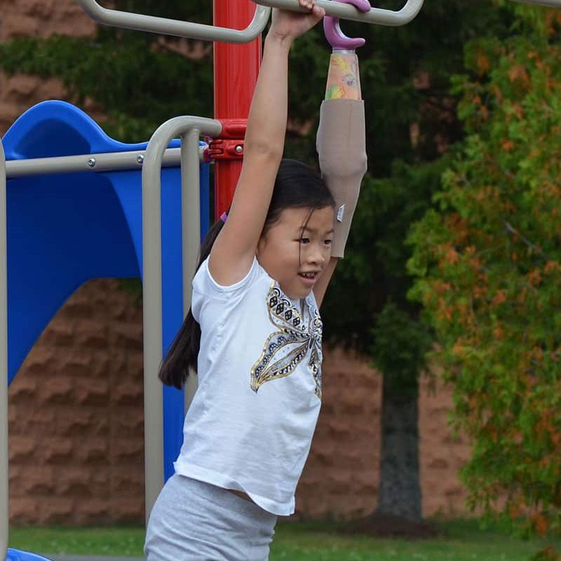 Picture of a girl hanging on monkey bars | Lawall Prosthetic & Orthotic Services