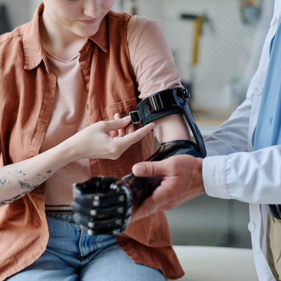 prosthetic_arm