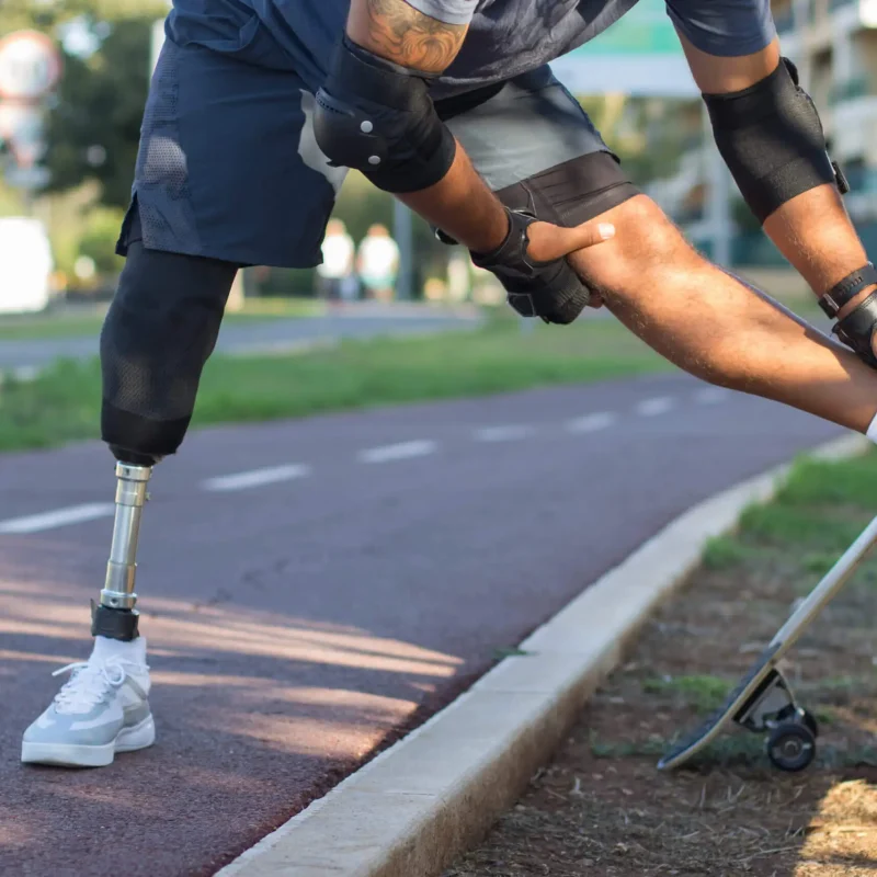 Sportsman with mechanical leg getting ready for training. Man in sport clothes stretching in park on summer day.